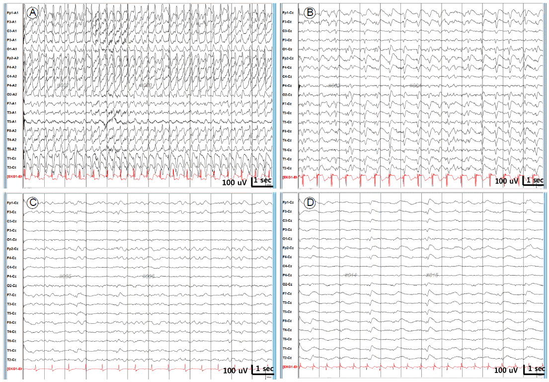 jkna-33-3-209f1.gif