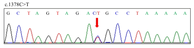 jkna-33-4-321f2.gif