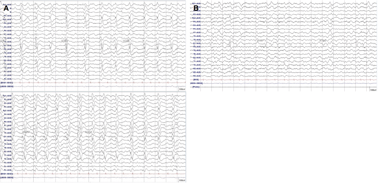 jkna-34-3-243f2.gif