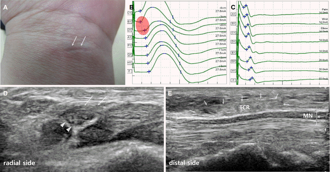 jkna-34-3-274f1.gif