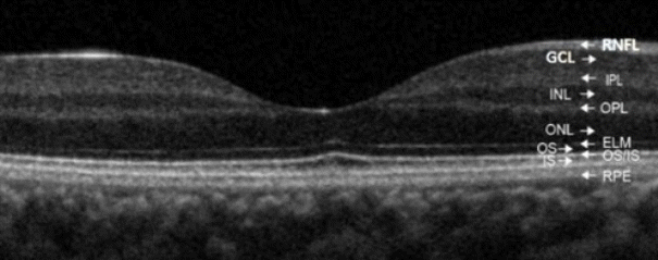 jkna-34-4-290f1.gif