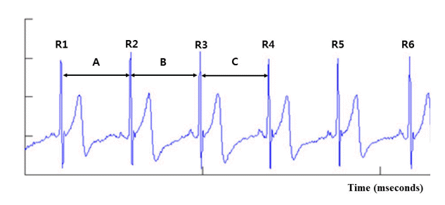 jkna-35-1-1f3.gif