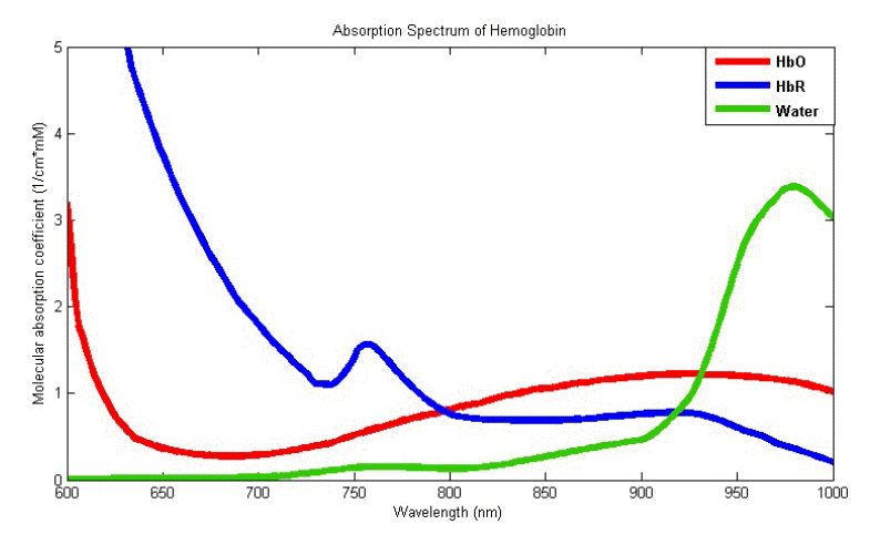 jkna-35-1-8f2.gif