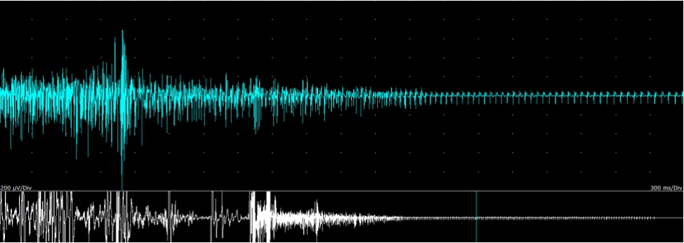 jkna-36-1-49f1.gif
