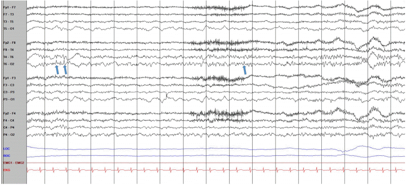 Figure 2.