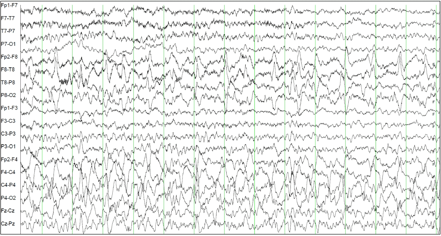 Figure 2.