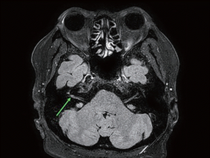 Figure 3.