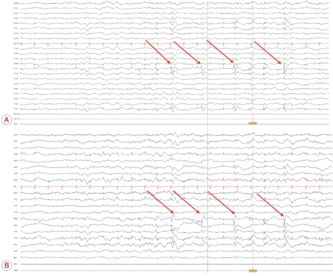 jkna-42-4-406f3.tif