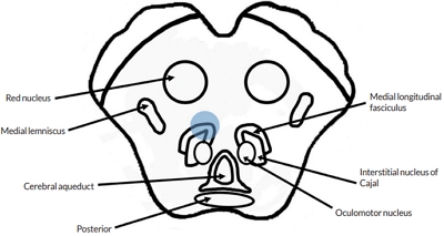 7087